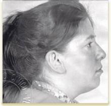 Fotografía de perfil de Pereira Gasagoite, René
